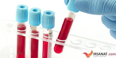 تفسیر نتایج آزمایش , آزمایش خون